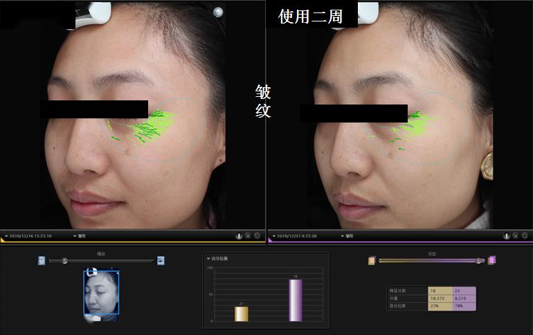 免费福利 | 你眼中的夏天是什么颜色?_皮肤