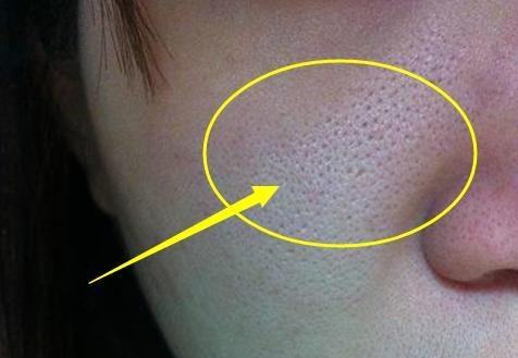 毛孔粗大都是洗出来的别再用这3类洗面奶白给都不要