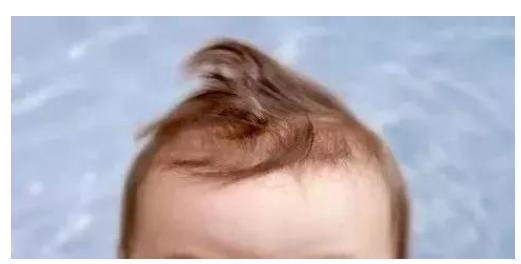 原创宝宝头发稀少怎么办这些护发常识要知道