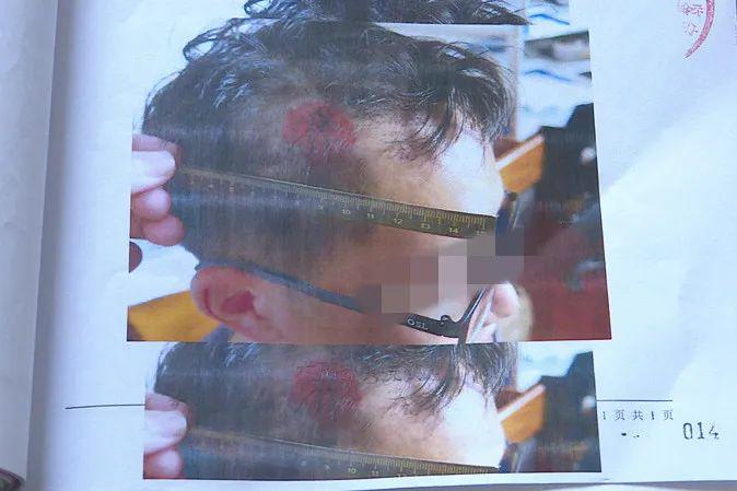 永安一名男子用弹弓将三人射伤他的履历令人惊心
