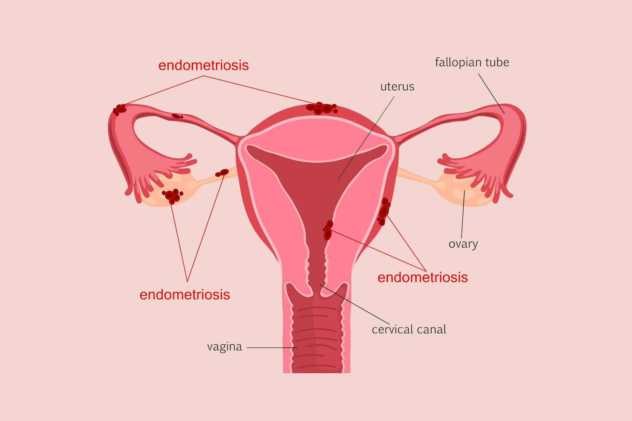 子宫颈解剖图及解释图片