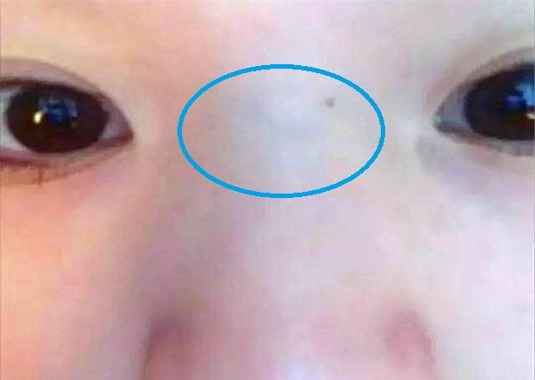 原创宝宝闹人不好带是因为鼻梁有青筋别乱信真正原因是这些