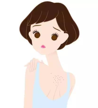 后背反复长痘中医告诉你原因在这里