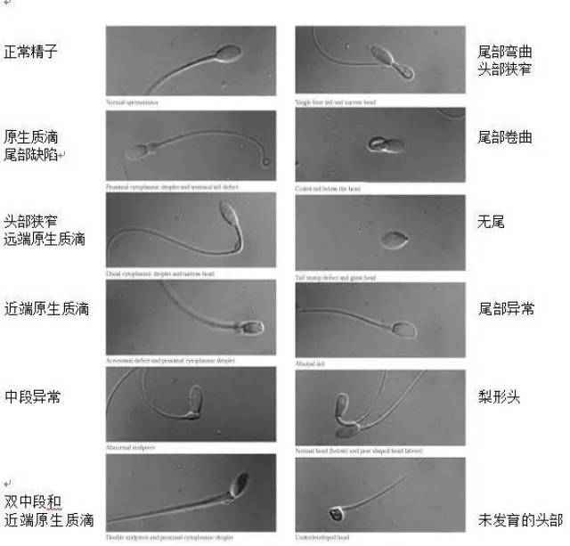 正常的精子参考图片