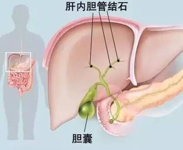 【暨赛国际】肝胆微环境净化疗法