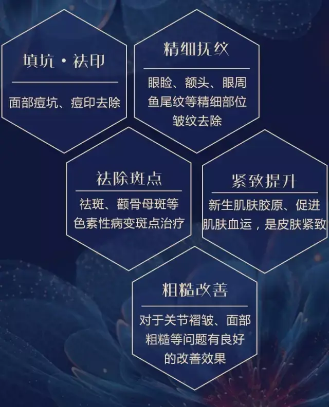 飞梭镭射激光案例