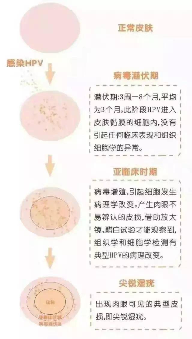 尖锐湿疣严重吗?不治疗会怎样?