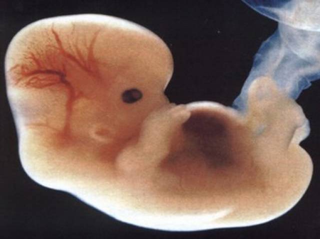 怀孕42天胎儿图片多大图片