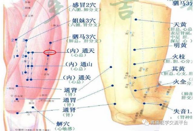 董氏奇穴常见穴位