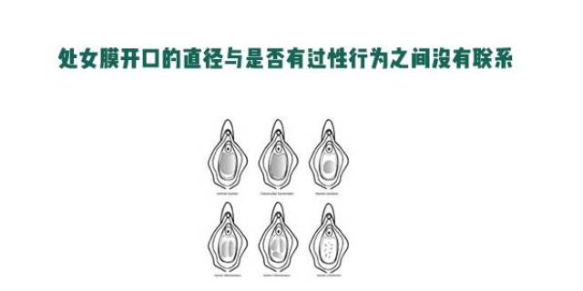 你对那层"膜"真的了解吗?