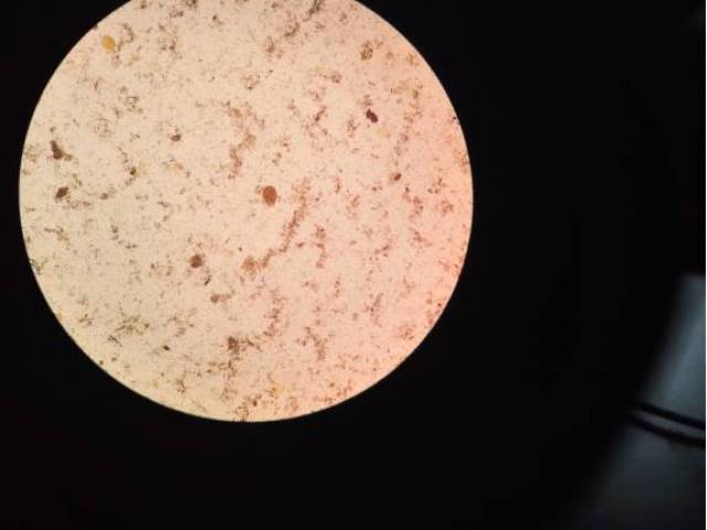 显微镜下的蛔虫卵图片