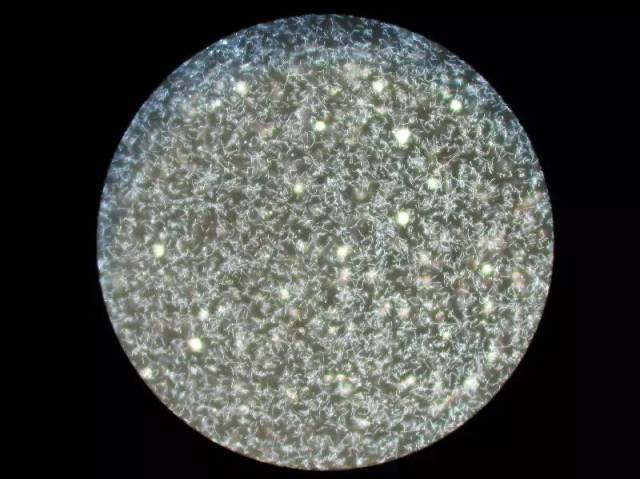 显微镜下的钩瑞螺旋体病毒