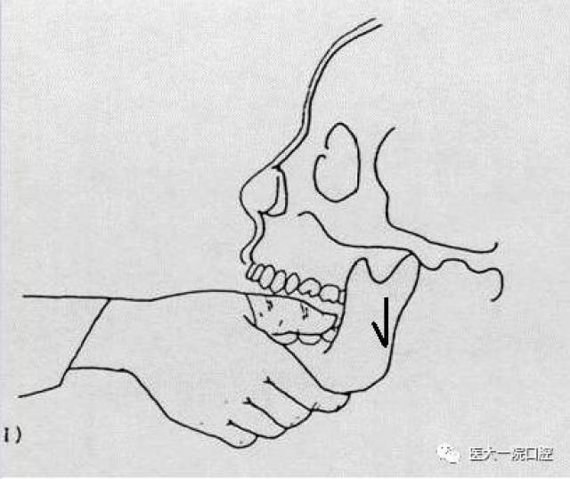 掉了下巴莫惊慌