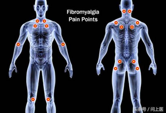 身體某些部位疼痛可能是這13個原因造成的,看看你是不是!