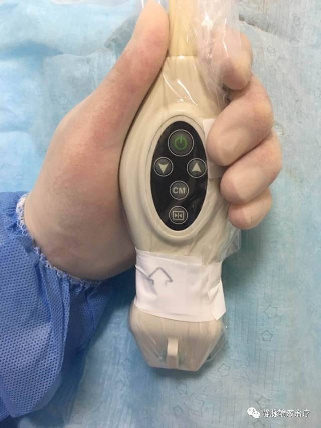 超声探头与穿刺针的故事