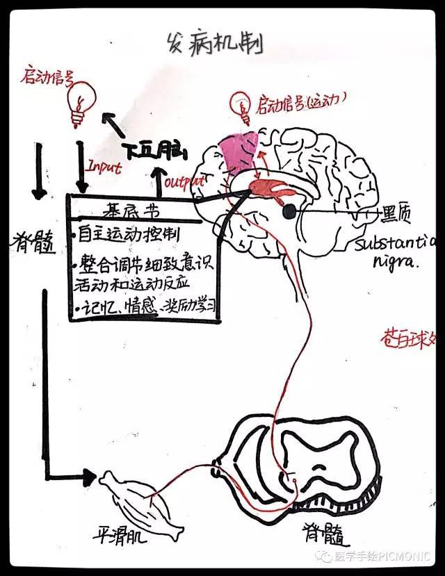 發病機制