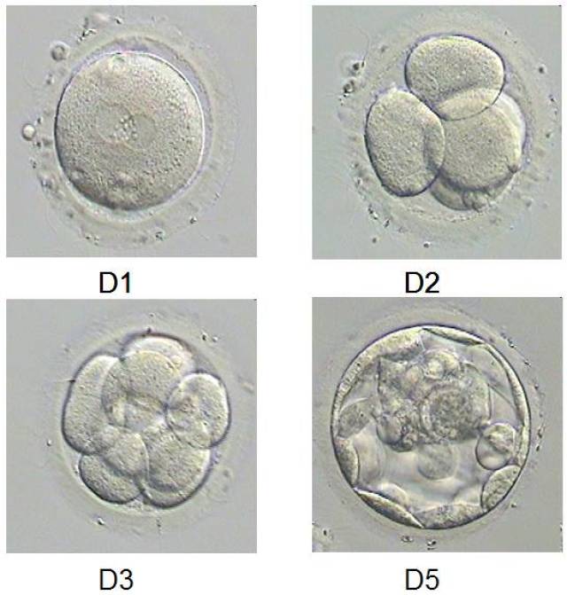 一级八细胞胚胎照片图片