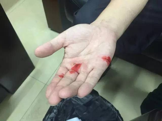 江门大道交警大队的民警在清理倒树中,手掌被树枝割破!