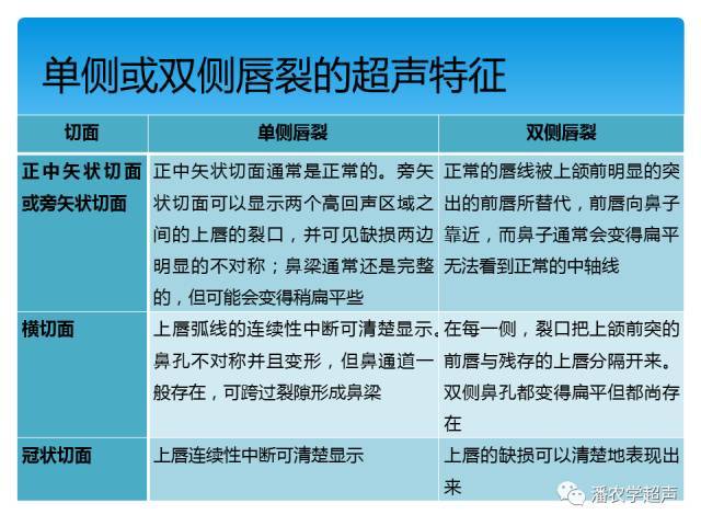 【超声微课堂】胎儿颜面部畸形超声诊断思路:中孕期唇裂和唇腭裂
