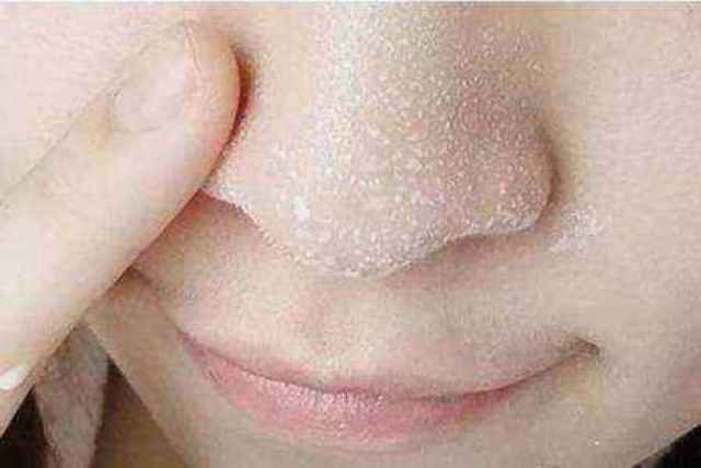 用盐洗脸的好处和坏处有哪些?会不会令皮肤受