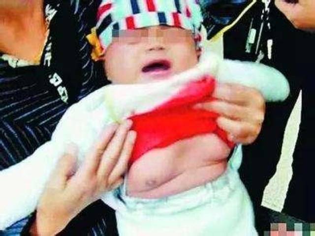 1岁女童长乳房,医生却说这是"微小青春期"不用治!原因是?_手机搜狐网
