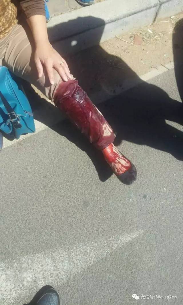 南非约堡华人商城区恶匪疯狂抢劫,华人女性被撞翻车受伤