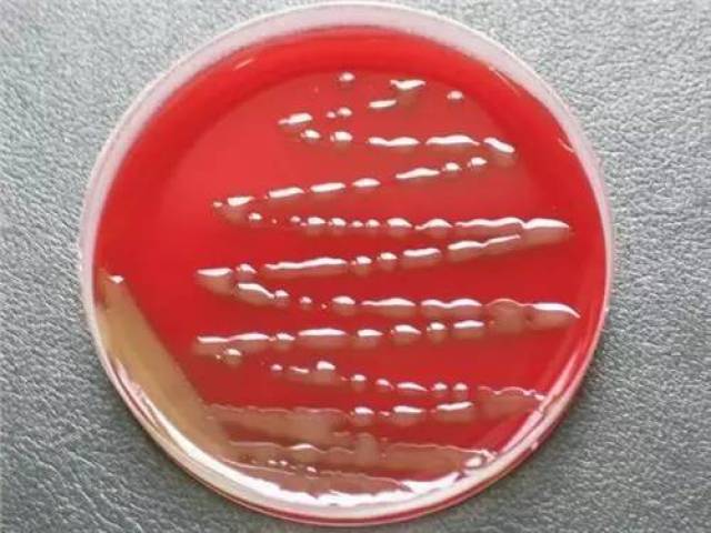 芽单胞菌门图片