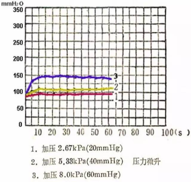 腰穿测压是否一定要下肢伸直?腰穿检查 6 