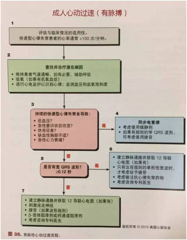 要命的心动过速!房性or室性?