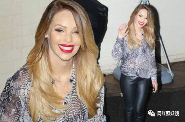 这位超模被泼硫酸毁容、遭强奸性虐待,如今整