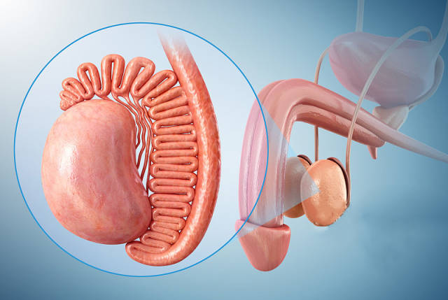 精索静脉曲张,男性不育的隐藏杀手