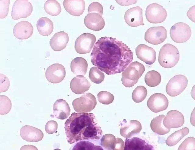 【临床】粒细胞系统各阶段细胞形态