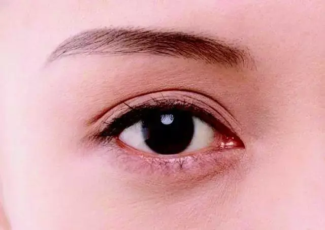 恐怖!杭州21岁妹纸倒头便睡,一觉醒来眼角膜都要烂了!