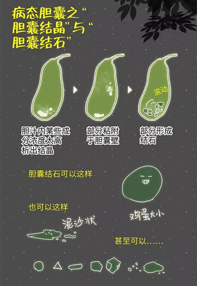 现代研究发现:胆囊具有极为复杂和重要的功能,是不可缺少和替代的重要