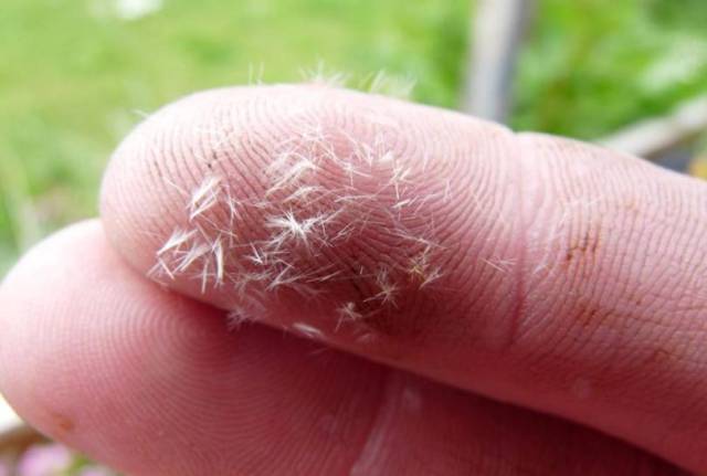 最最可怕的是, 它们身上的毛刺有剧毒 ,当人碰触到它们时就会脱落并