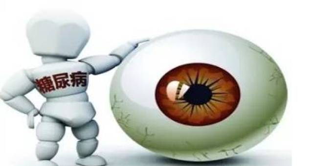 糖尿病视网膜病变最常见的眼底病:1糖尿病视网膜病变,高度近视或运动