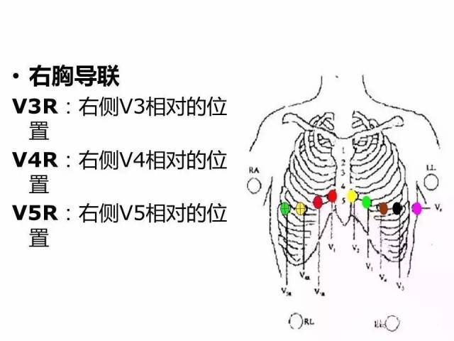 【收藏】想要心电图机测的准?这些步骤千万不能省(12导联,18导联通用)