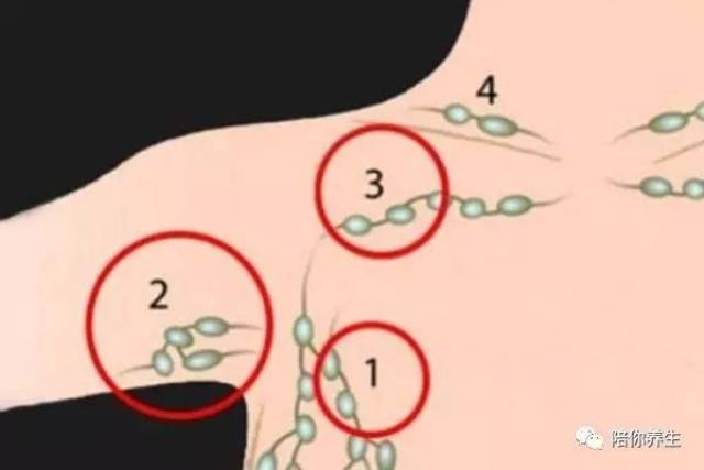 腋窝淋巴结检查的顺序图片