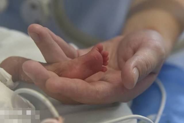 心疼,南宁一新生儿刚出生5天就要上手术台!原来是因为.