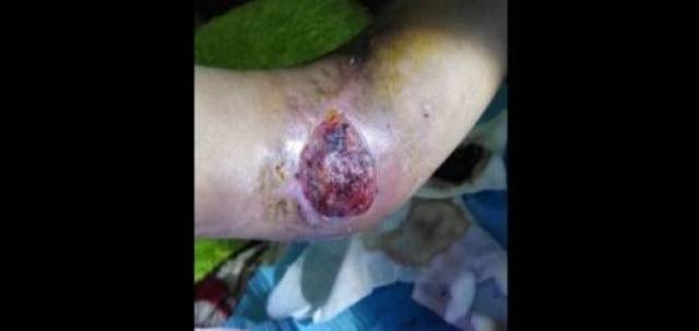 换了医院又动了手术又做了轻创手术,可今年过完年以后春节以后,那个