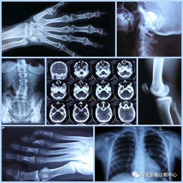 拍x光不像通常人们所用的照相机,拍左边颜面部时就看不到右边,而x光