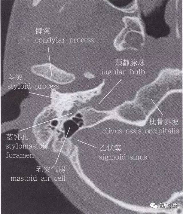 斜坡解剖位置图片