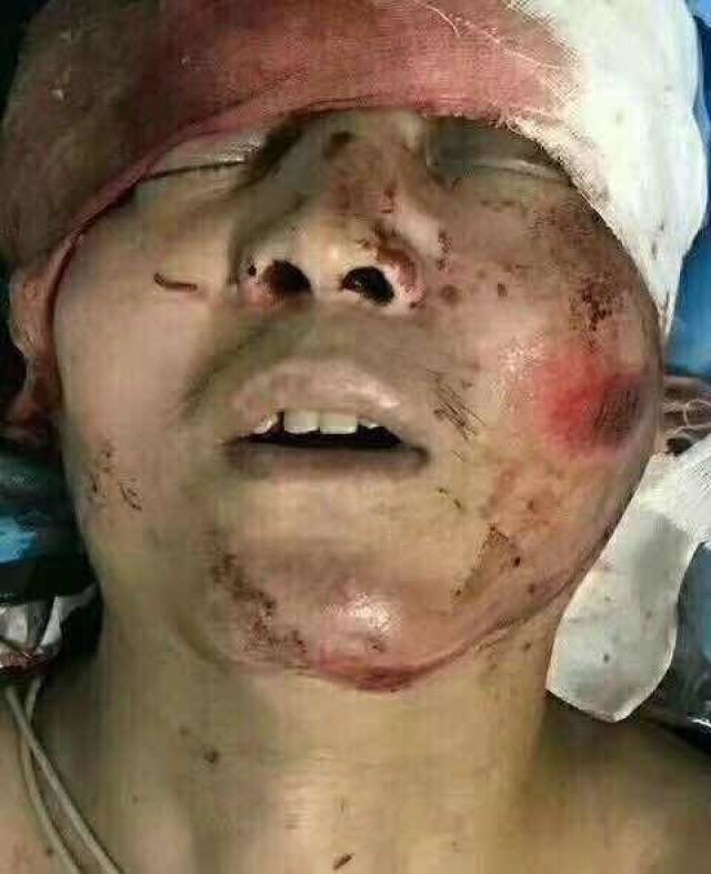 一男子倒地浑身是血!全城急寻家属