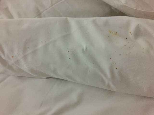 10天不洗床单,百万螨虫陪你睡!太可怕了