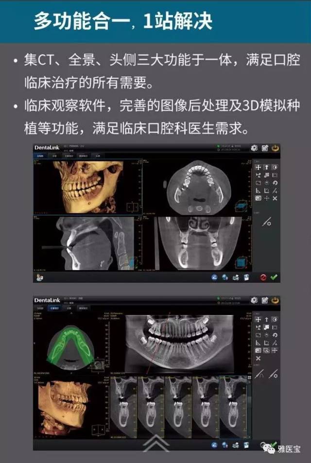 性价比之王——菲森cbct,新款上市!