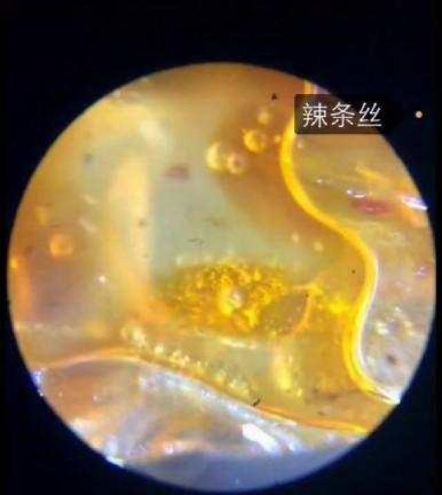 辣条显微镜放大有虫子图片