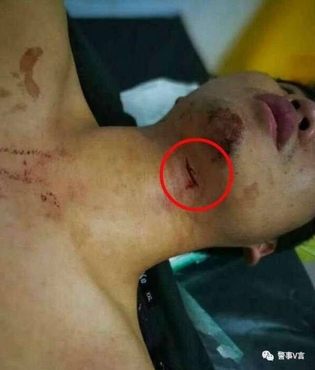 丹东警察被割喉图片图片