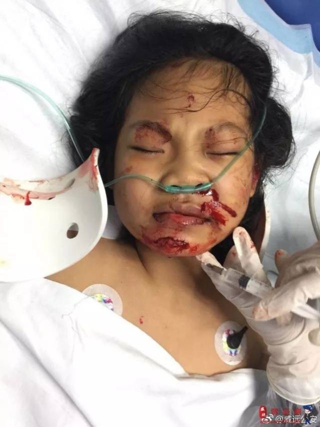 孩子家长已找到新中医院门口小女孩遭遇车祸最新消息发布