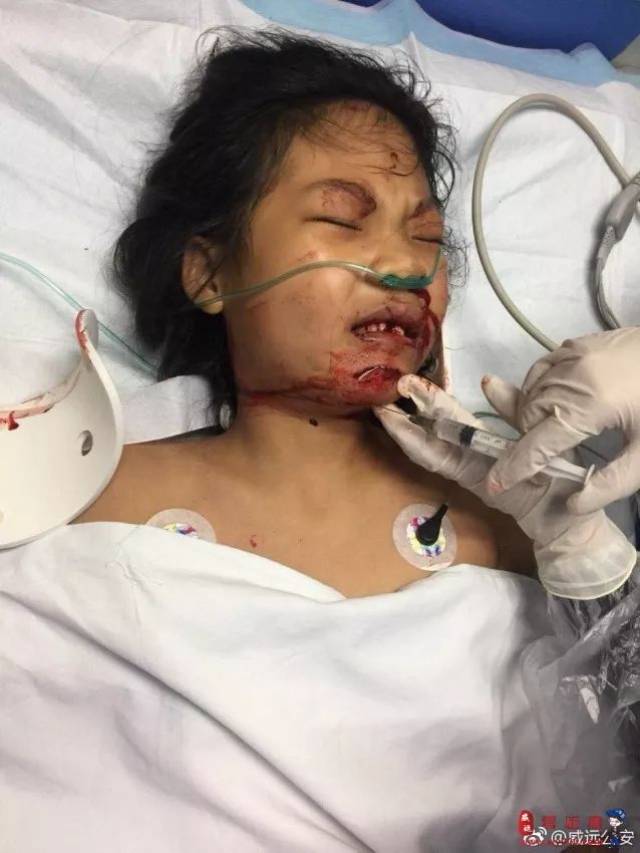 孩子家长已找到新中医院门口小女孩遭遇车祸最新消息发布