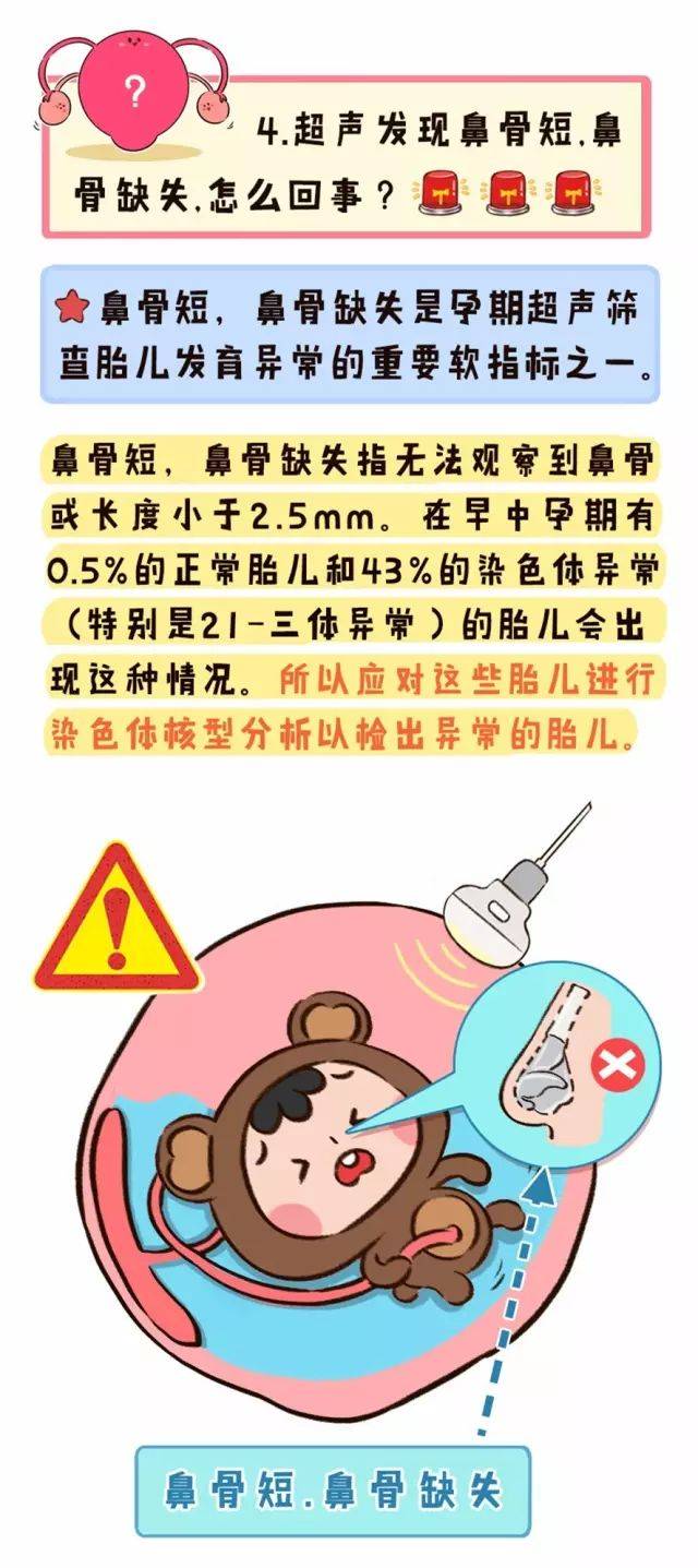 胎儿鼻骨对照表图片